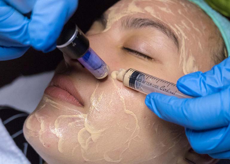 The Facial Treatment That’ll Keep You Looking Forever Young