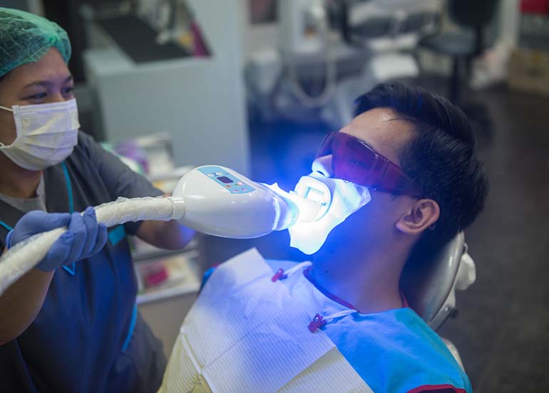 teeth-whitening-procedure