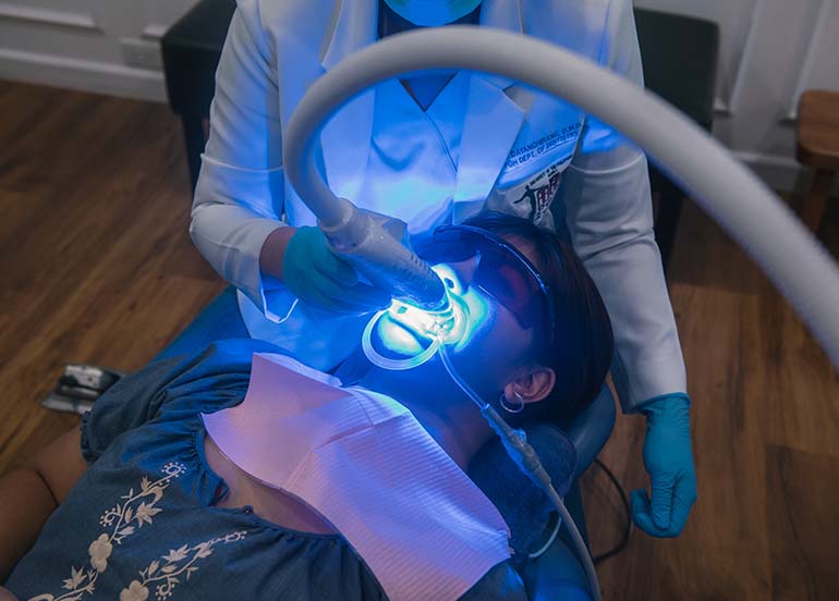 laser-teeth-whitening