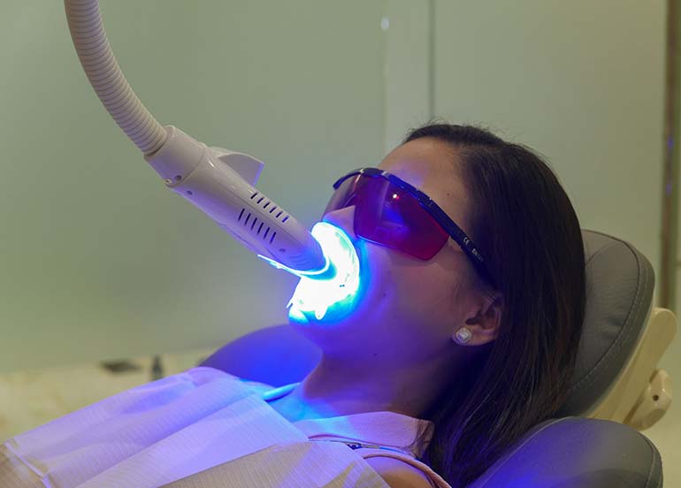 teeth-whitening-treatment