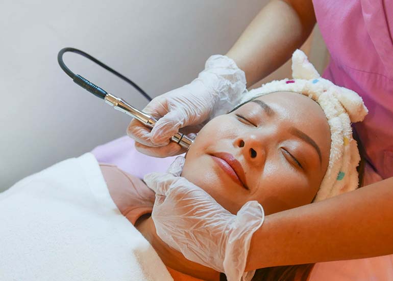 diamond-peel-facial