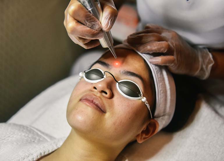 revlite-laser-treatment