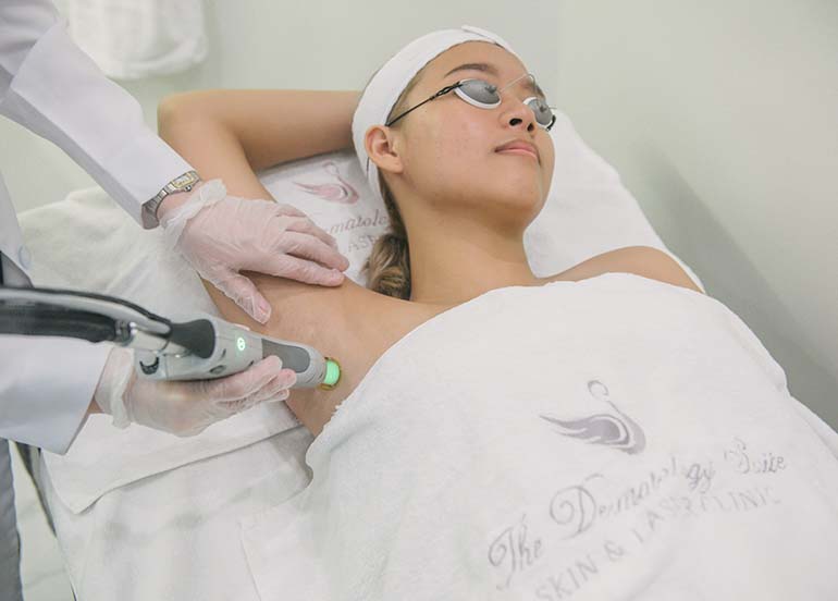 Woman skin laser in armpit
