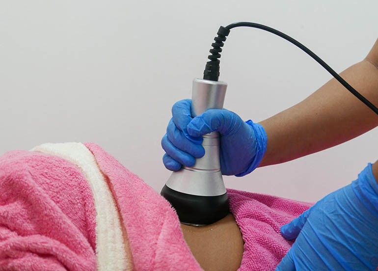 RF with Cavitation (any area of choice) at Skin 911